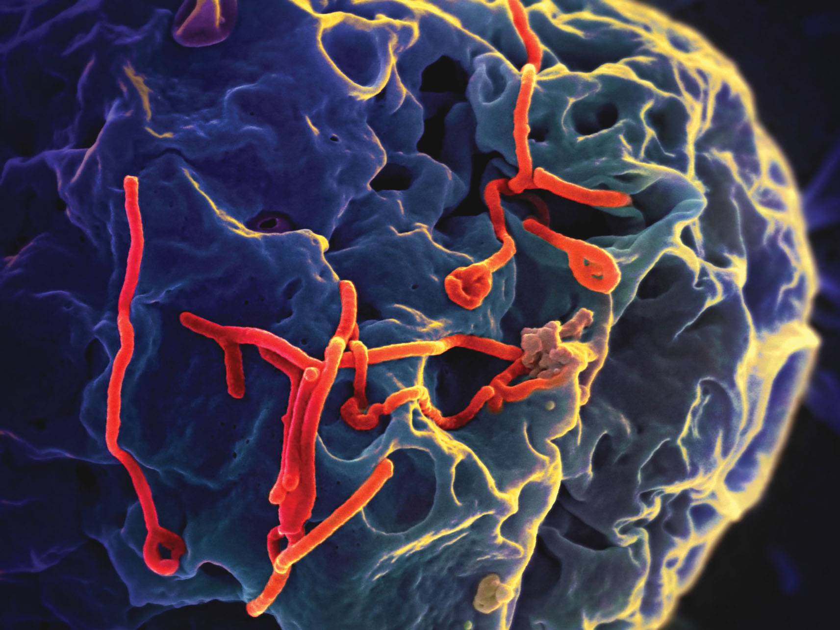A greatly enlarged image of the Ebola virus budding from the surface of a Vero cell. (Image courtesy of the National Institute of Allergy and Infectious Disease.)