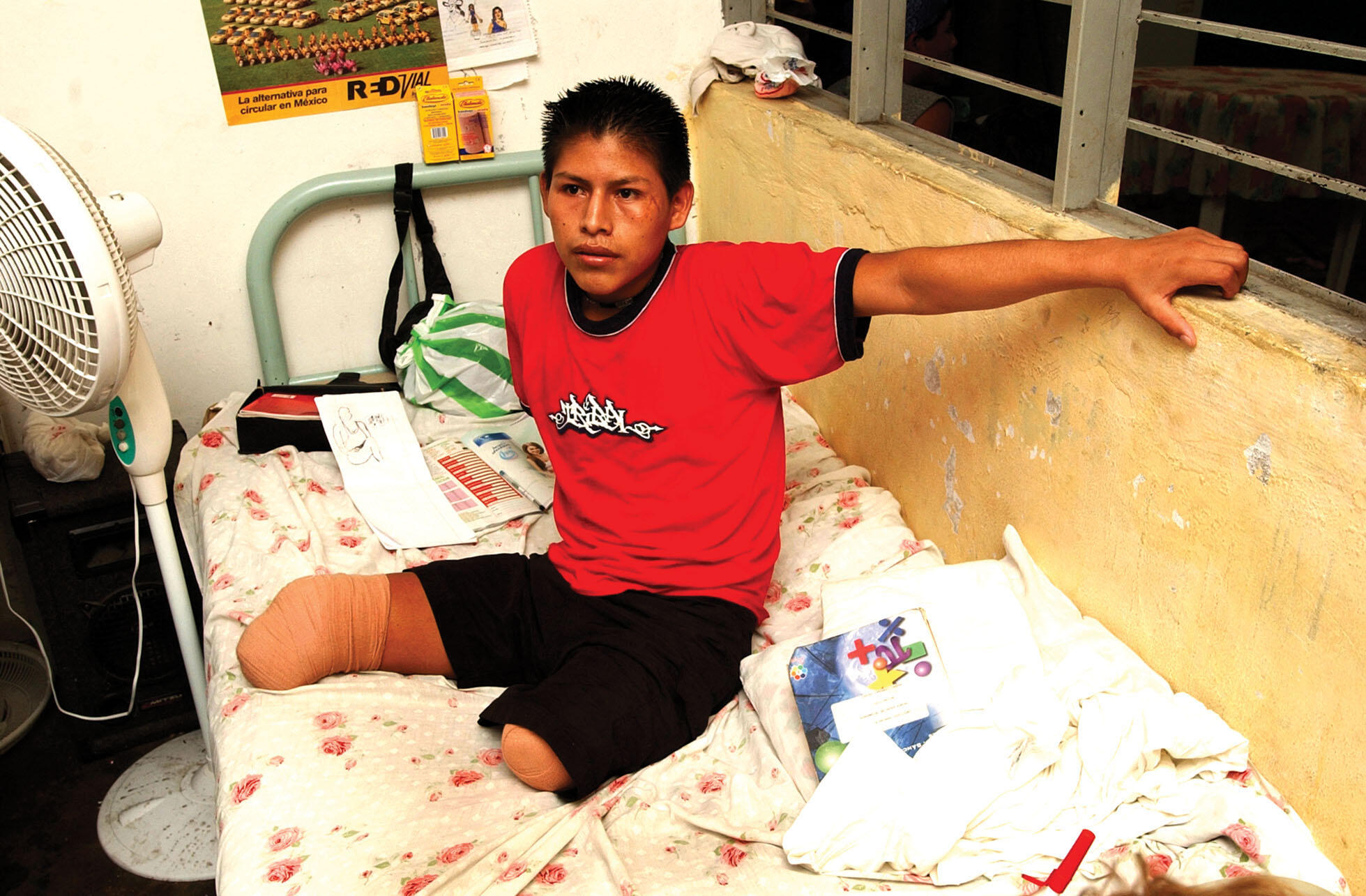 A young migrant who lost his legs when he fell from a train receives care in the Jesús El Buen Pastor shelter in Tapachula, Mexico. (Photo by Karl Gehring/Denver Post via Getty Images.)